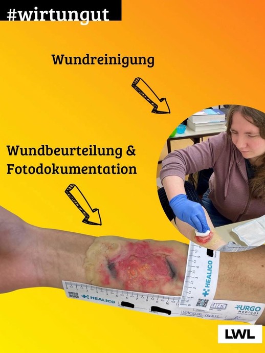Wundmanagement an der LWL-Pflegeschule Marsberg (vergrößerte Bildansicht wird geöffnet)